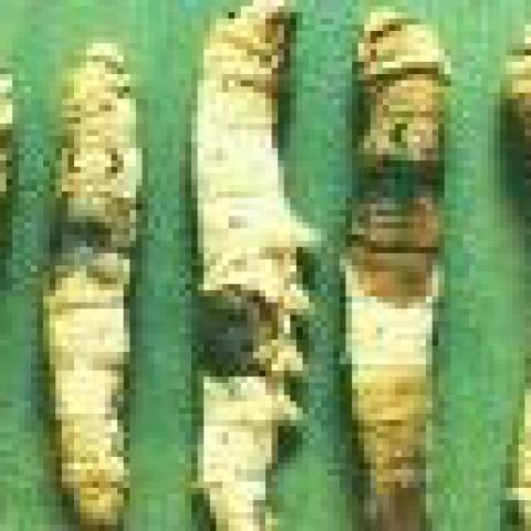 Foto 27 - Aspergilosis